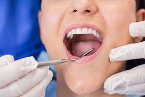 Preventative Dentistry | Alex Bratic Dental Care - Dentist Beenleigh