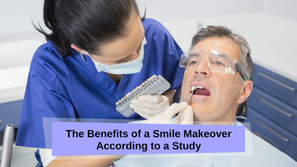 The Benefits of a Smile Makeover According to a Study
