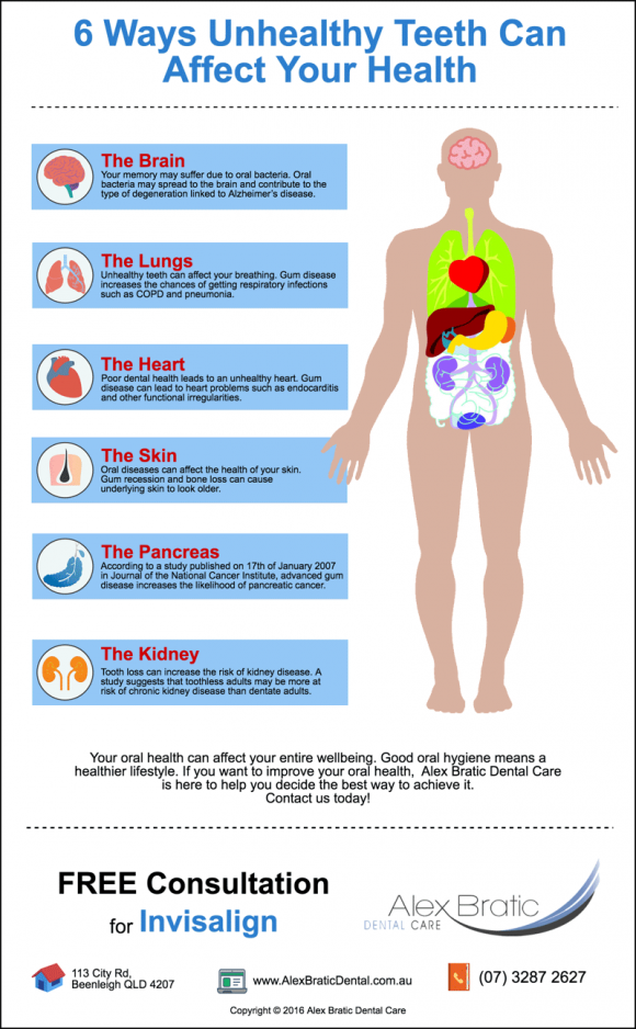 beenleigh-dentist-trivia-6-ways-unhealthy-teeth-can-affect-your-health2x Beenleigh Dentist Trivia: 6 Ways Unhealthy Teeth Can Affect Your Health