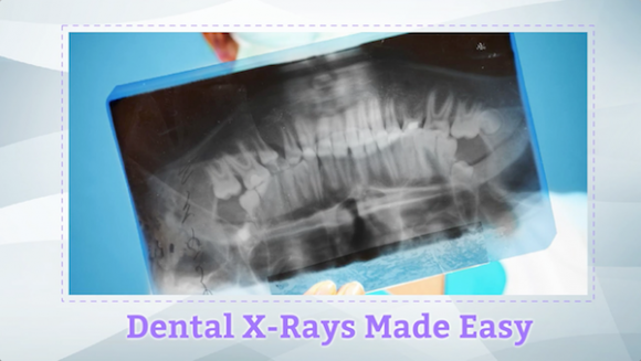 Everything You Need To Know About Modern Dental X-rays