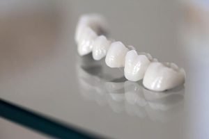 How Long Do Dental Crowns Last | Dentist Beenleigh