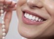 Improve Your Life With A Smile Makeover beenleigh dentist